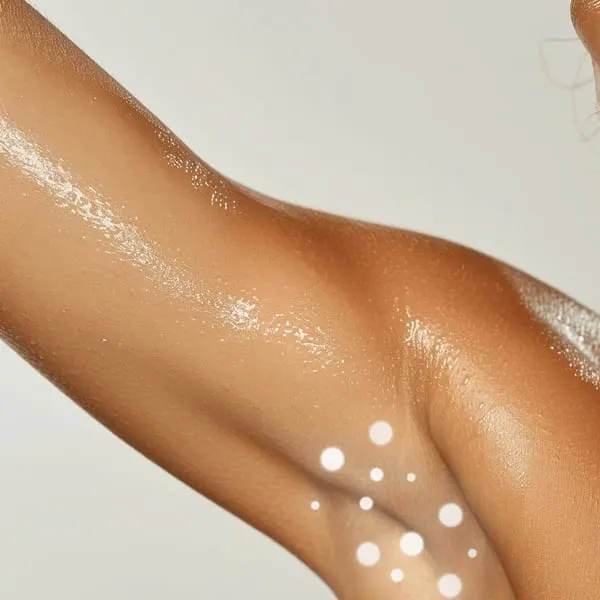 Schwitzenbehandlung mit Botox®